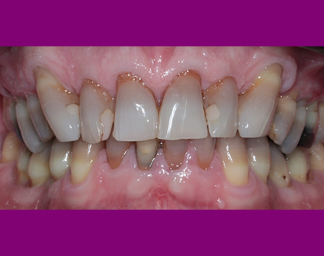 Before - Droitwich Spa Dental